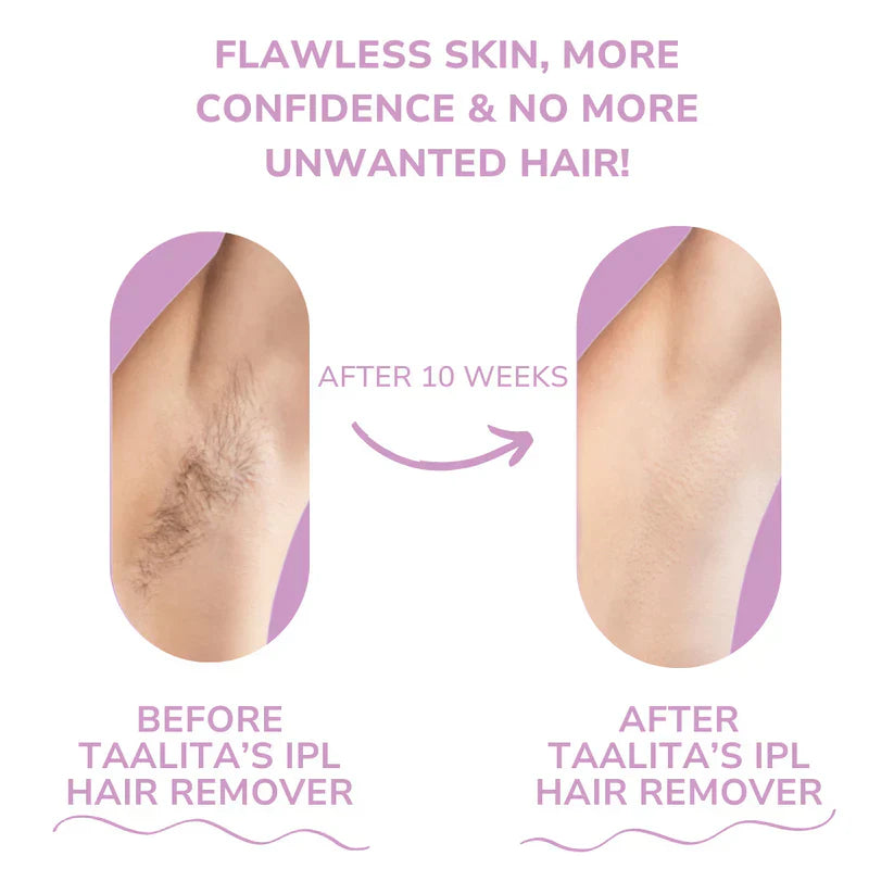 Beauty Plus IPL Hair Remover