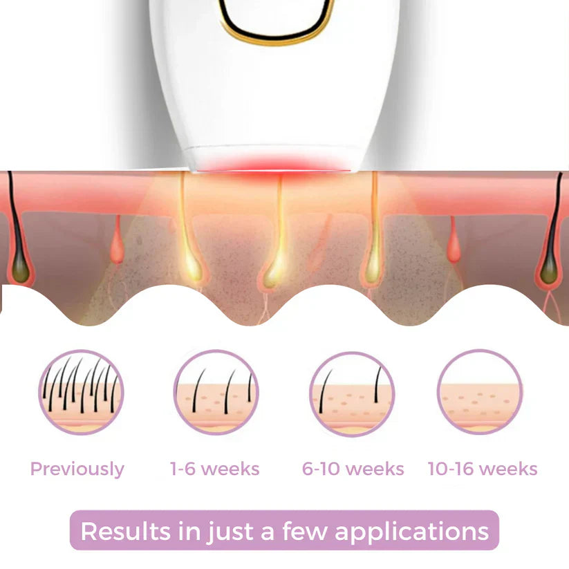 Beauty Plus IPL Hair Remover
